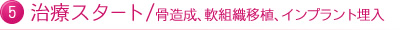 5治療スタート/骨造成、軟組織移植、インプラント埋入