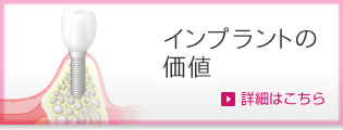 インプラントの価値 詳細はこちら